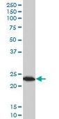 Monoclonal Anti-TPT1, (C-terminal) antibody produced in mouse clone 2C4, purified immunoglobulin, buffered aqueous solution