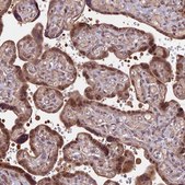 Anti-HDAC5 antibody produced in rabbit Prestige Antibodies&#174; Powered by Atlas Antibodies, affinity isolated antibody, buffered aqueous glycerol solution