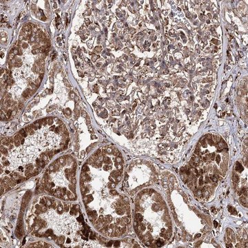Anti-FANCL antibody produced in rabbit Prestige Antibodies&#174; Powered by Atlas Antibodies, affinity isolated antibody, buffered aqueous glycerol solution