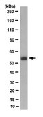 Anti-Retinal Dehydrogenase 1/ALDH1A1 Antibody, clone 8D7.1 clone 8D7.1, from mouse