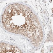 Anti-CHKA antibody produced in rabbit Prestige Antibodies&#174; Powered by Atlas Antibodies, affinity isolated antibody, buffered aqueous glycerol solution