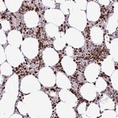 Anti-HMGB2 antibody produced in rabbit Prestige Antibodies&#174; Powered by Atlas Antibodies, affinity isolated antibody, buffered aqueous glycerol solution