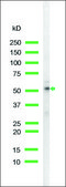 Anti-Keratin 18 antibody, Rabbit monoclonal clone SP69, recombinant, expressed in proprietary host, affinity isolated antibody