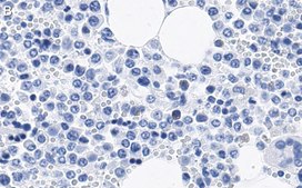 Anti-CD11b Antibody, clone 2G13 ZooMAb&#174; Rabbit Monoclonal recombinant, expressed in HEK 293 cells