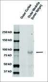 Anti-SCNN1B antibody produced in rabbit 1&#160;mg/mL, affinity isolated antibody