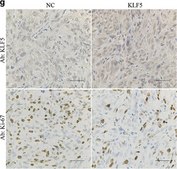 Anti-KLF5 antibody produced in rabbit Prestige Antibodies&#174; Powered by Atlas Antibodies, affinity isolated antibody, buffered aqueous glycerol solution