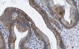 Anti-Parkin Antibody, clone 2J8 ZooMAb&#174; Rabbit Monoclonal recombinant, expressed in HEK 293 cells