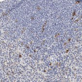 Anti-ITGAX antibody produced in rabbit Prestige Antibodies&#174; Powered by Atlas Antibodies, affinity isolated antibody, buffered aqueous glycerol solution