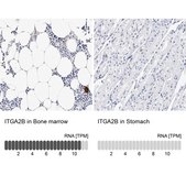 Anti-ITGA2B antibody produced in rabbit Prestige Antibodies&#174; Powered by Atlas Antibodies, affinity isolated antibody, buffered aqueous glycerol solution