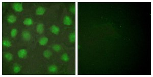 Anti-Retinoid X Receptor &#947; antibody produced in rabbit affinity isolated antibody