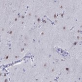 Anti-TBR1 Prestige Antibodies&#174; Powered by Atlas Antibodies