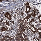 Anti-APOD antibody produced in rabbit Prestige Antibodies&#174; Powered by Atlas Antibodies, affinity isolated antibody