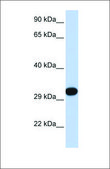 Anti-PDGFB antibody produced in rabbit affinity isolated antibody