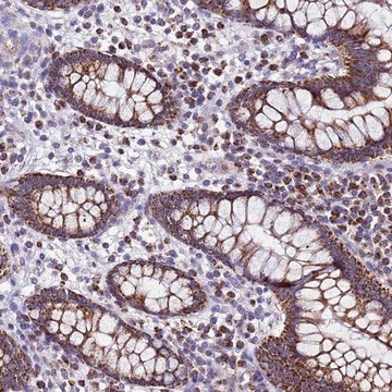 Anti-UEVLD antibody produced in rabbit Prestige Antibodies&#174; Powered by Atlas Antibodies, affinity isolated antibody, buffered aqueous glycerol solution