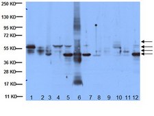 Anti-Cytokeratin AE1/AE3 Antibody, recognizes acidic &amp; basic cytokeratins, clone AE1/AE3 clone AE1/AE3, Chemicon&#174;, from mouse