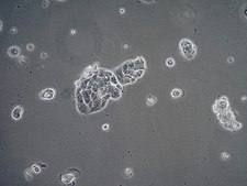 Calu-3 Human Lung Adenocarcinoma Cell Line
