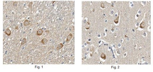 Anti-Limk1 Antibody, clone 6C3.1| MABN118 clone 6C3.1, from mouse