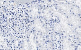 Anti-PEDF (SERPIN F1) Antibody, clone 2C16 ZooMAb&#174; Rabbit Monoclonal recombinant, expressed in HEK 293 cells