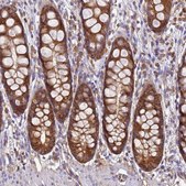 Anti-NARS antibody produced in rabbit Prestige Antibodies&#174; Powered by Atlas Antibodies, affinity isolated antibody, buffered aqueous glycerol solution