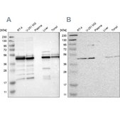 Anti-UQCRC2 antibody produced in rabbit Prestige Antibodies&#174; Powered by Atlas Antibodies, affinity isolated antibody, buffered aqueous glycerol solution