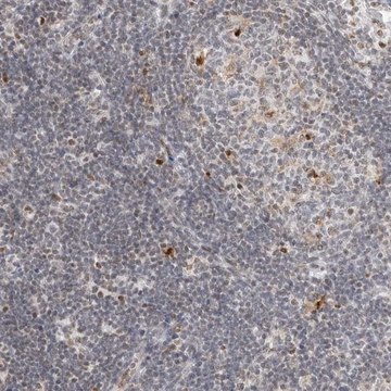 Anti-C1orf162 antibody produced in rabbit Prestige Antibodies&#174; Powered by Atlas Antibodies, affinity isolated antibody, buffered aqueous glycerol solution