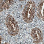 Monoclonal Anti-DIAPH2 antibody produced in mouse Prestige Antibodies&#174; Powered by Atlas Antibodies, clone CL1111, purified immunoglobulin, buffered aqueous glycerol solution