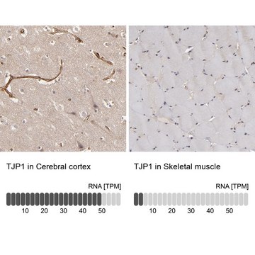 Anti-TJP1 antibody produced in rabbit Ab2, Prestige Antibodies&#174; Powered by Atlas Antibodies, affinity isolated antibody, buffered aqueous glycerol solution