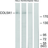 Anti-Collagen V &#945;1 antibody produced in rabbit affinity isolated antibody