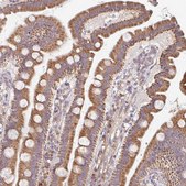 Anti-SKP2 antibody produced in rabbit Prestige Antibodies&#174; Powered by Atlas Antibodies, affinity isolated antibody, buffered aqueous glycerol solution