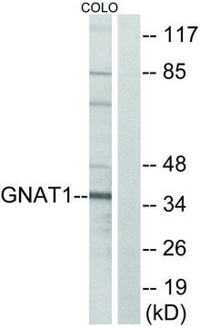 Anti-GNAT1 antibody produced in rabbit affinity isolated antibody