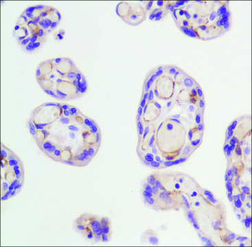 Anti-FLK-1 (mouse) antibody, Rabbit monoclonal recombinant, expressed in proprietary host, clone SP123, affinity isolated antibody