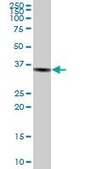 Anti-GAPDH antibody produced in mouse purified immunoglobulin, buffered aqueous solution