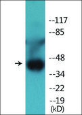 Anti-phospho-p47 phox (pSer359) antibody produced in rabbit affinity isolated antibody