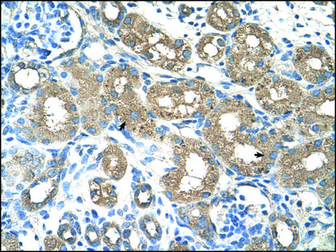 Anti-ALAS2 antibody produced in rabbit IgG fraction of antiserum