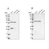 Anti-PAH antibody produced in rabbit Prestige Antibodies&#174; Powered by Atlas Antibodies, affinity isolated antibody, buffered aqueous glycerol solution