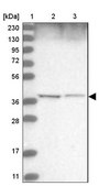 Anti-WDR92 antibody produced in rabbit Prestige Antibodies&#174; Powered by Atlas Antibodies, affinity isolated antibody, buffered aqueous glycerol solution