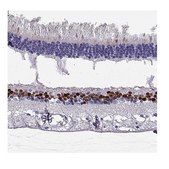 Anti-VSX2 antibody produced in rabbit Prestige Antibodies&#174; Powered by Atlas Antibodies, affinity isolated antibody, buffered aqueous glycerol solution