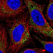 Anti-COL5A1 antibody produced in rabbit Prestige Antibodies&#174; Powered by Atlas Antibodies, affinity isolated antibody, buffered aqueous glycerol solution