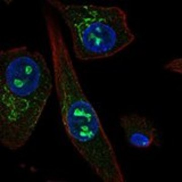 Anti-SOSTDC1 antibody produced in rabbit Prestige Antibodies&#174; Powered by Atlas Antibodies, affinity isolated antibody, buffered aqueous glycerol solution