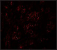 Anti-PION antibody produced in rabbit affinity isolated antibody, buffered aqueous solution