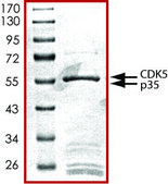 CDK5/p35., active, GST tagged human PRECISIO&#174; Kinase, recombinant, expressed in baculovirus infected Sf9 cells, &#8805;70% (SDS-PAGE), buffered aqueous glycerol solution