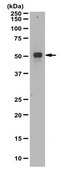 Anti-MNX1 (HB9) Antibody from rabbit, purified by affinity chromatography