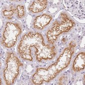Anti-TMEM174 antibody produced in rabbit Prestige Antibodies&#174; Powered by Atlas Antibodies, affinity isolated antibody, buffered aqueous glycerol solution