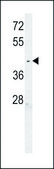 ANTI-C6ORF58 (CENTER) antibody produced in rabbit IgG fraction of antiserum, buffered aqueous solution