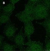 Anti-phospho-Stat1-Tyr701 Antibody, clone 1F23 ZooMAb&#174; Rabbit Monoclonal recombinant, expressed in HEK 293 cells
