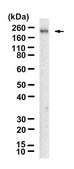 Anti-Nephrin Antibody, clone 1D16 ZooMAb&#174; Rabbit Monoclonal recombinant, expressed in HEK 293 cells