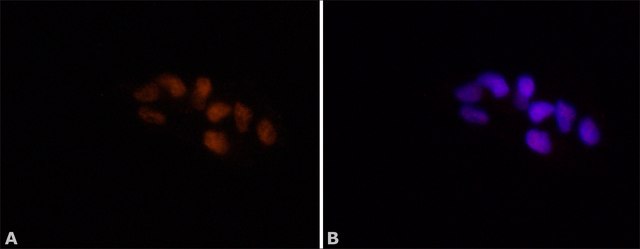 Anti-ADAR1 antibody produced in rabbit ~1.0&#160;mg/mL, affinity isolated antibody