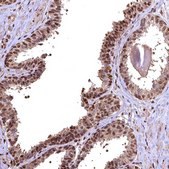 Anti-GAPDH antibody produced in rabbit Prestige Antibodies&#174; Powered by Atlas Antibodies, affinity isolated antibody, buffered aqueous glycerol solution