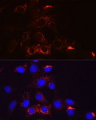 Anti-PDGFRB Antibody, clone 6E8C10, Rabbit Monoclonal