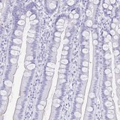 Anti-TIMP1 antibody produced in rabbit Prestige Antibodies&#174; Powered by Atlas Antibodies, affinity isolated antibody, buffered aqueous glycerol solution